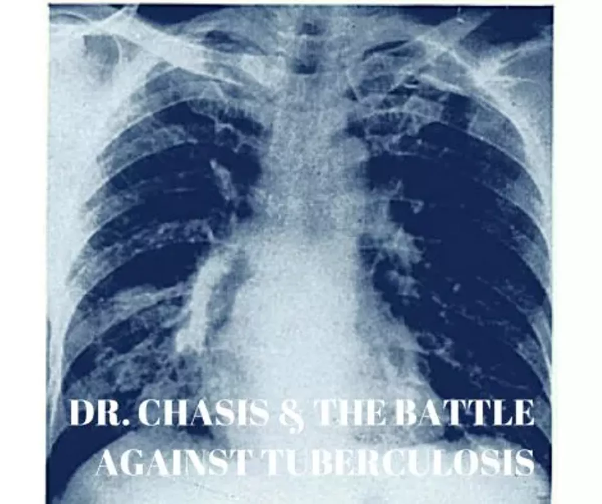 tuberculosis.webp