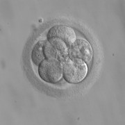 Ohio Judge Rules Embryos Are Not People in University Hospitals Case